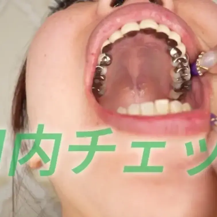 妖湖さん監督の口内チェック動画です。銀歯を見せつけたり、チキン食べたりしてます。