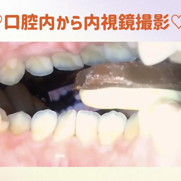 ♡口内から内視鏡を使って撮影をしました
♡咀嚼・指噛みシーンあり
♡食べられてしまった気分を味わいたい方にオススメ