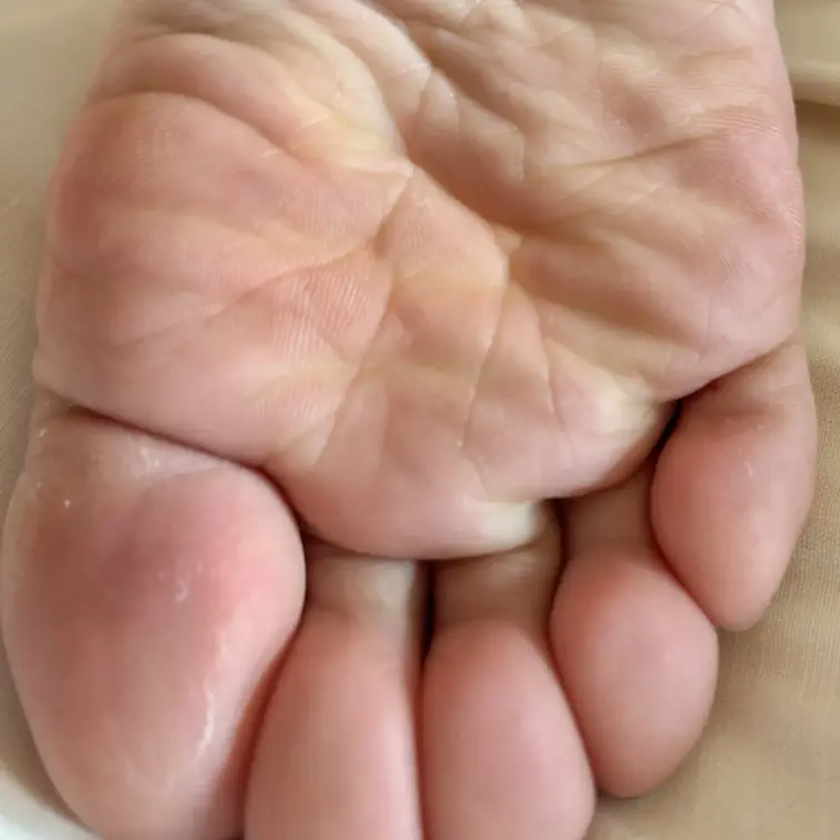 足裏指先アップ