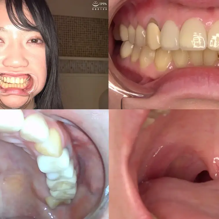 【歯フェチ】「清楚美女 葉月英里チャンの超・超・超貴重な口内・銀歯・のどちんこ観察！」葉月英里

清楚美女 葉月英里