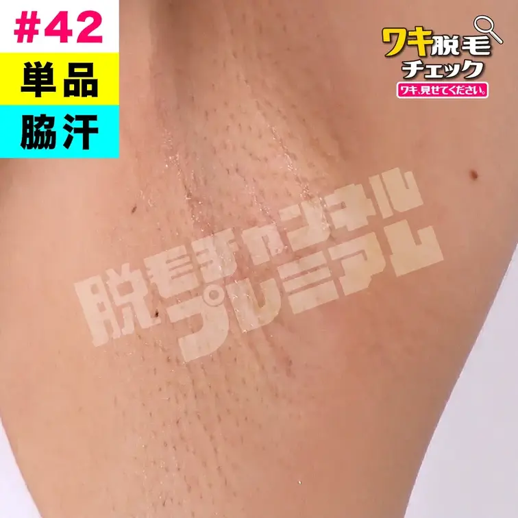 【単品販売】【脇汗】女子大生のワキ脱毛チェック 学生編#42（モデル：アツコ）
シリーズ：ワキ脱毛チェック 学生編