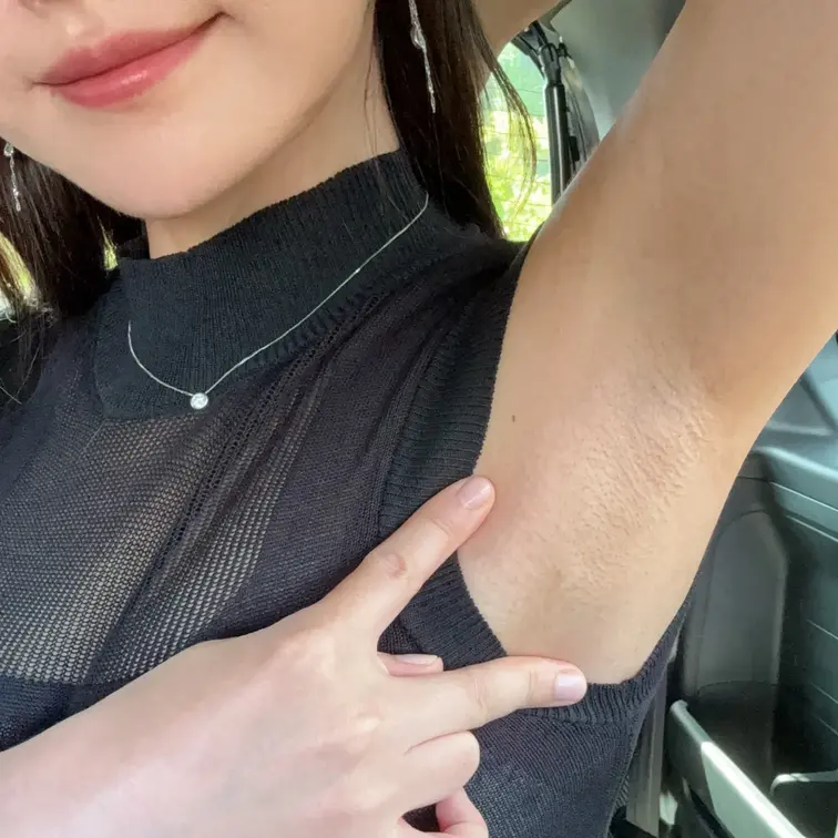 2枚目〜超ドアップ無加工ワキ毛穴です🥹♡

私はレーザー脱毛をしてるので
ほとんど腋毛は生えないのですが
それで