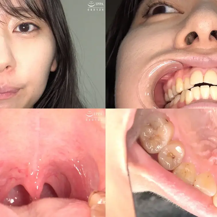 「【口内】めちゃカワ美女かたよせ萩花ちゃんの激レア口内・のどちんこ観察！」かたよせ萩花  4K作品

めちゃカワ美女 かたよせ萩花チャンの貴重な口内・のどちんこ観察プレイをお届け致します！

まずはマウスオープナーをしてもらいしっかりと歯を観察！

汚れが残るめちゃくちゃ卑猥な歯をじっくりと激写！

アングル変えて様々なカットをお届けします。

さらにはのどちんこをじっくりと観察！

激レア映像が撮れました！

しっかりと汚れが残るここまで可愛い女の子の口内はなかなかありませんので是非！！！

【収録時間】
15分25秒

【モデル】
かたよせ萩花 25歳
T167 B85(Eカップ) W57 H83
A型
趣味 水泳
特技 水泳
東京都出身
-------------------------------------------------
MP4形式です。
出演者は身分証確認により１８歳以上であることを確認しています。
映像は１８歳未満閲覧禁止、第三者に提供、譲渡、販売等の行為を行うことは一切禁止します。
無断でアップロードしているサイトなどがありましたらお知らせください！
皆様のご協力を宜しくお願い致します。 (1/2)
