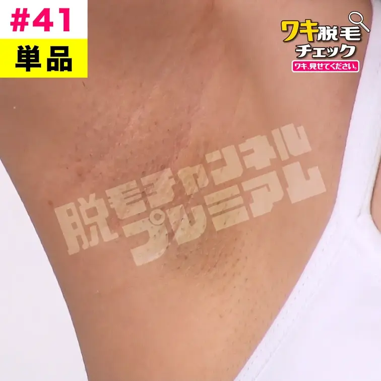 【単品販売】女子大生のワキ脱毛チェック 学生編#41（モデル：マリン）
シリーズ：ワキ脱毛チェック 学生編