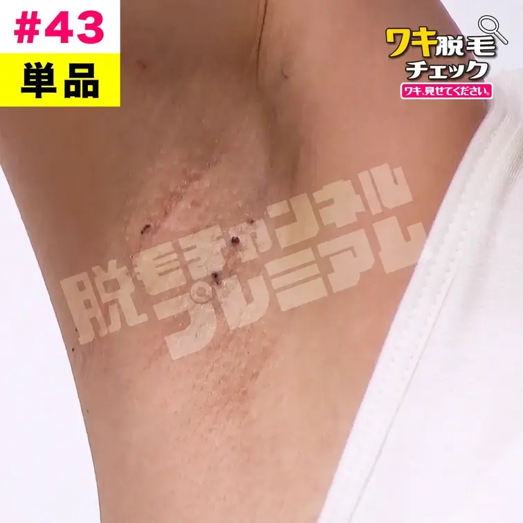【単品販売】女子大生のワキ脱毛チェック 学生編#43（モデル：モモカ）
シリーズ：ワキ脱毛チェック 学生編