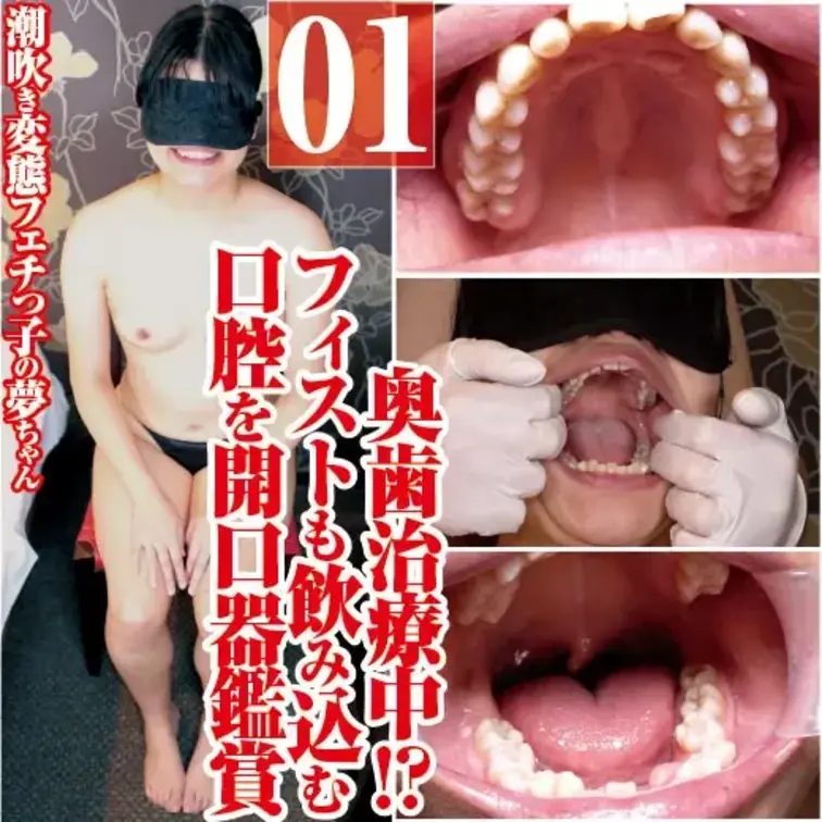 潮吹き変態の夢ちゃん奥歯治療中!?フィストも飲み込む口腔開口器鑑賞

潮吹き変態フェチっこの夢ちゃんの
口腔を開口