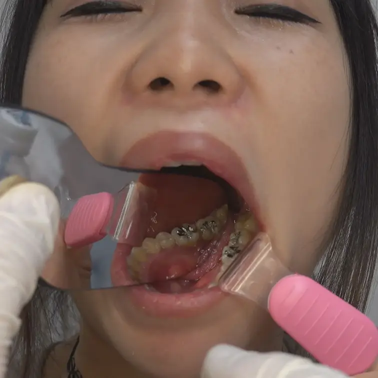 口腔治療室 動画2