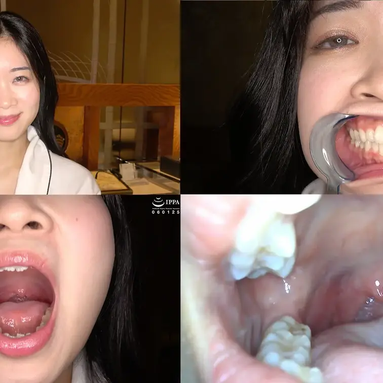 【口内】「国民的女優激似美女ことねチャンの初めての口内観察！」ADOA-104 ことね⑤

