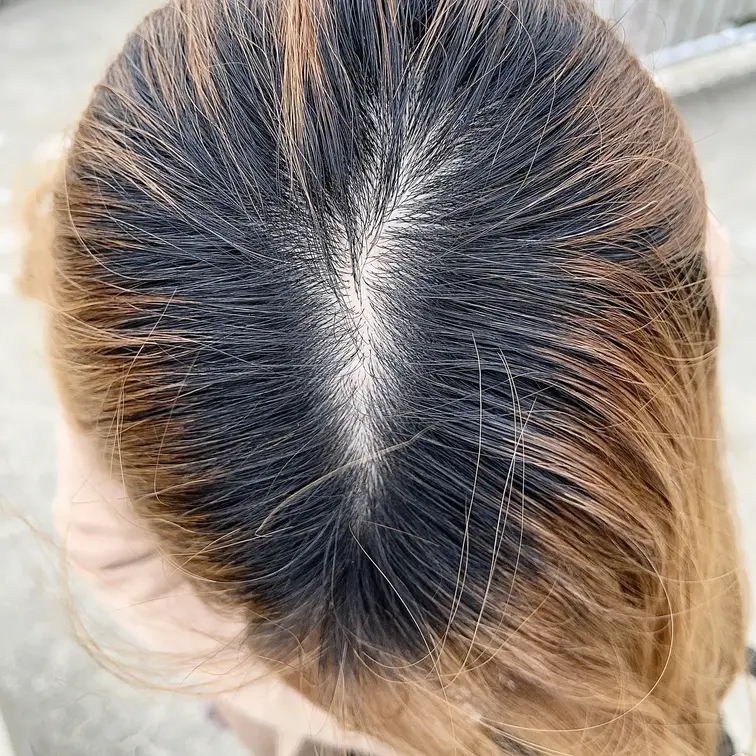プリン分け目が好きな方へ❤️接写。