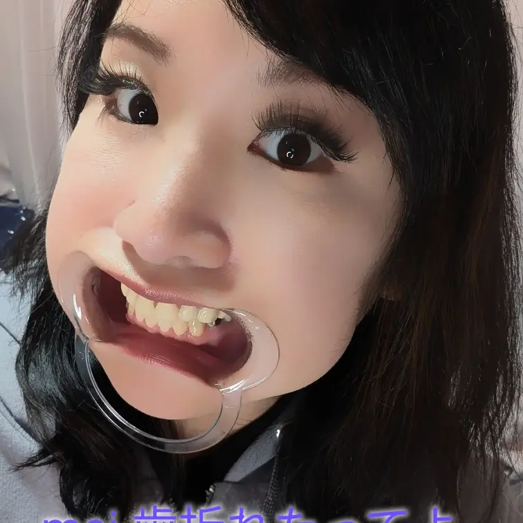 歯について語ってます。