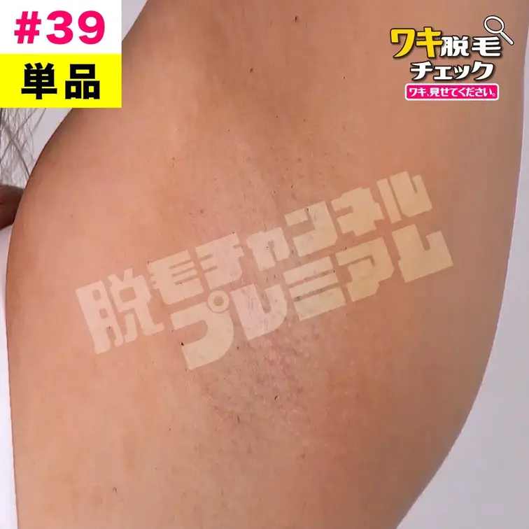 【単品販売】女子大生のワキ脱毛チェック 学生編#39（モデル：ツグミ）
シリーズ：ワキ脱毛チェック 学生編