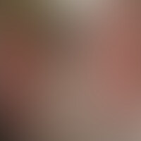 初めての乱交体験で、乱交プレーがトラウマになっちゃた？？
あの体験から、アブノーマルなプレーが頭から離れない・・・。

だから！またあの快感を味わってみたい！！もっと快楽を堪能したい！！
と、「美緒さん」は意欲満々で再参加！！

前回以上に、快楽を堪能する「美緒さん」。
当然今回も潮を吹きながら、何度も絶頂を味わってよがり狂いました。 (2/2)