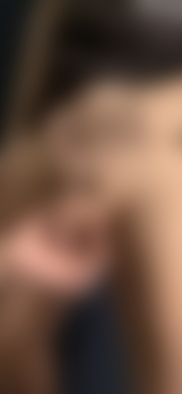 睾丸容量測定 sample 1
