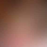 「ずっと妄想してたんです。自分以外の男性に彼女が抱かれるコトを・・・。」
そんな寝取られ願望を持つカップルさんが企画に参加!!
そんな彼のの夢が遂に実現。
一度に沢山の手による愛撫・・・何本ものチンコを・・・。
そんな願望通り、複数の男性でたっぷりと可愛がってあげました。
彼氏の目の前で他人棒を挿入され、大胆に感じちゃった「はるなさん」。
そんな姿を見て、彼氏も大満足!! (2/2)