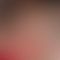首輪を装着すると、マゾモードに突入する「みゆさん」。
だから首輪&リードで、男性陣にご奉仕させる・・・。
そんなシチュエーションでどんどんマゾモードに入っちゃう「みゆさん」。
ご奉仕で男性に気持ちよくなってもらった後は、たっぷりと複数のチンコのご褒美!
「一杯私を苛めて下さい。そうされることが最高の喜びなの!!」 (2/2)