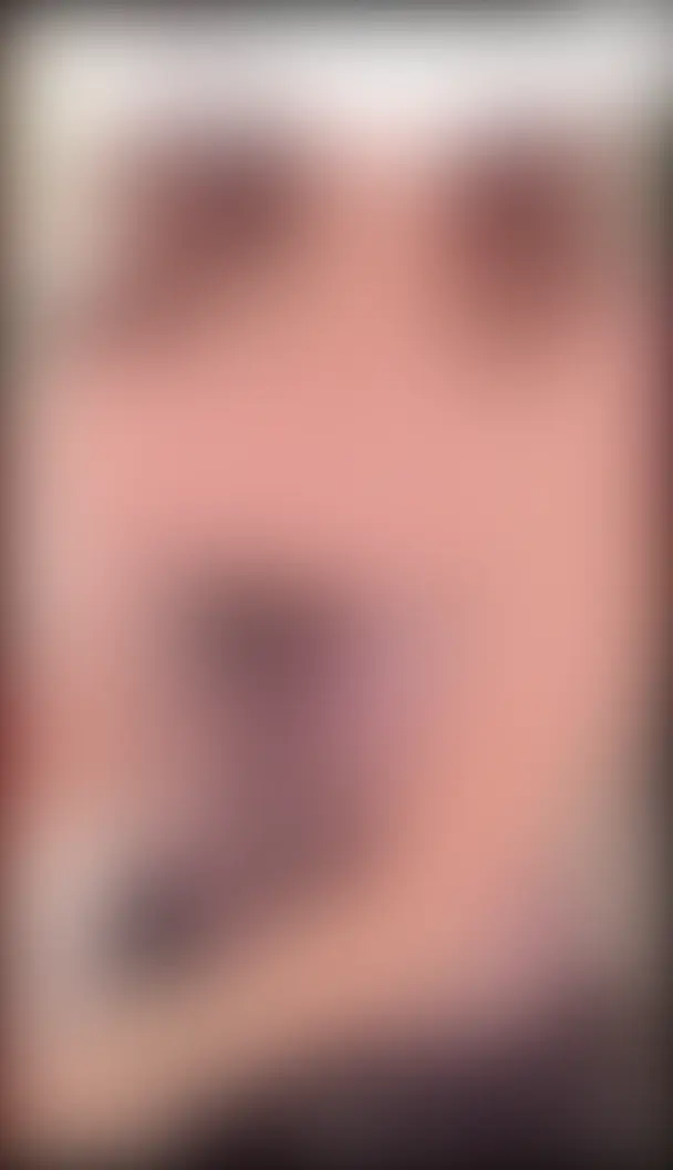 オエジェル１０ヶ月🩷胸膨らんできたかな🩷 sample 1