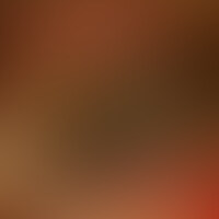 ずっと前から興味がありました・・・。
複数の男性に、めちゃめちゃにされてみたいんです・・・。

そんな願望を持ち、濃厚な乱交体験をしてみたいと企画に参加した｢ひなちゃん｣。
強引に上と下の穴に同時にチンコを挿れられたいとリクエスト！

目隠し・両手を縛った状態で襲いかかる男性陣・・・。
強引に、上と下のお口とに○○○チンコをぶち込まれる・・・。

15人の男性からの強引な扱いが、次第に快感に？？
そんなハードなプレーで「ひなちゃん」は、身体を痙攣させながら絶頂を迎えました。 (2/2)