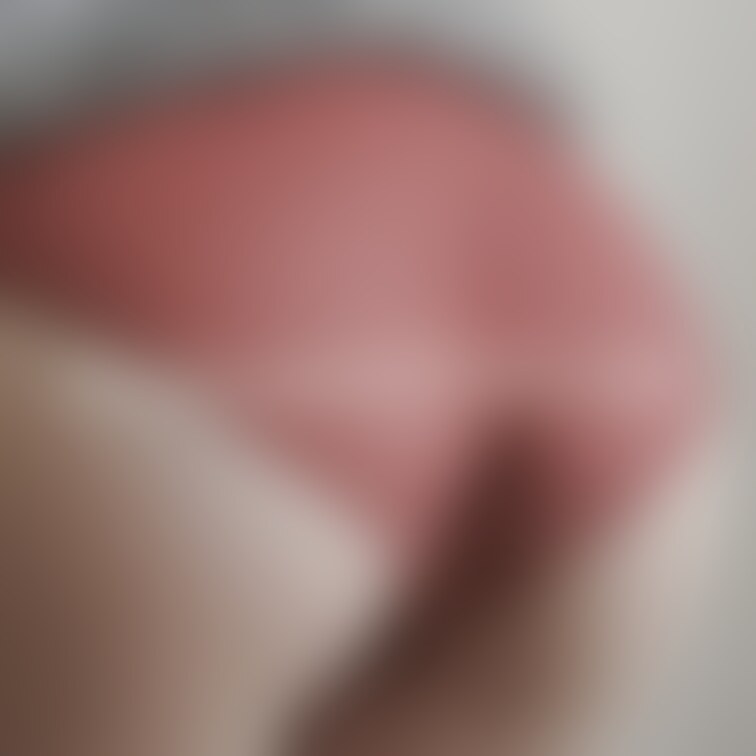 もちろんおしりのお写真も撮ってあるよ🍑
お洋服の跡が残っちゃってるけど☺️💦