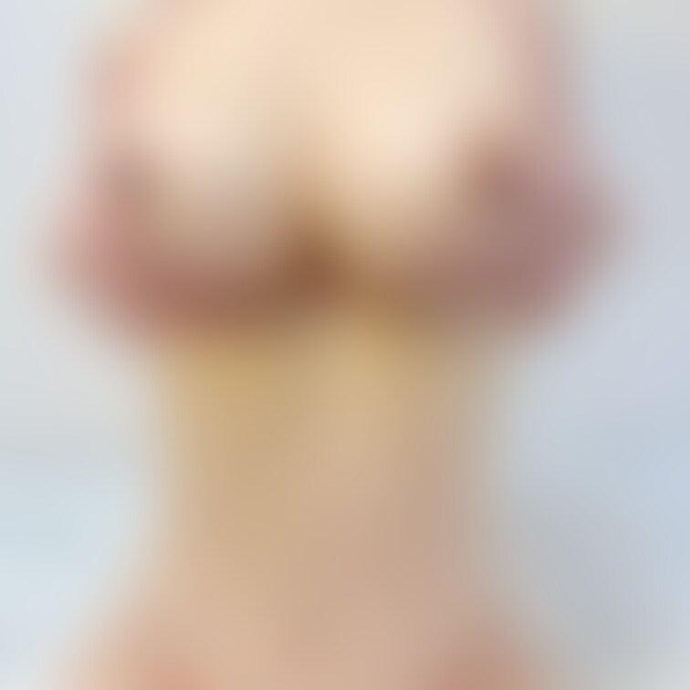 ビキニシリーズのオッパイ出しPartⅡです😁