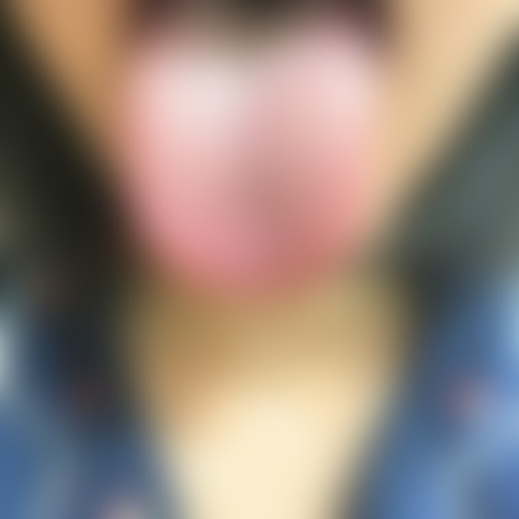 舌15