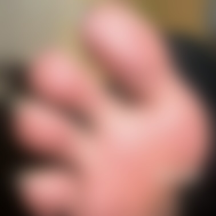 足
