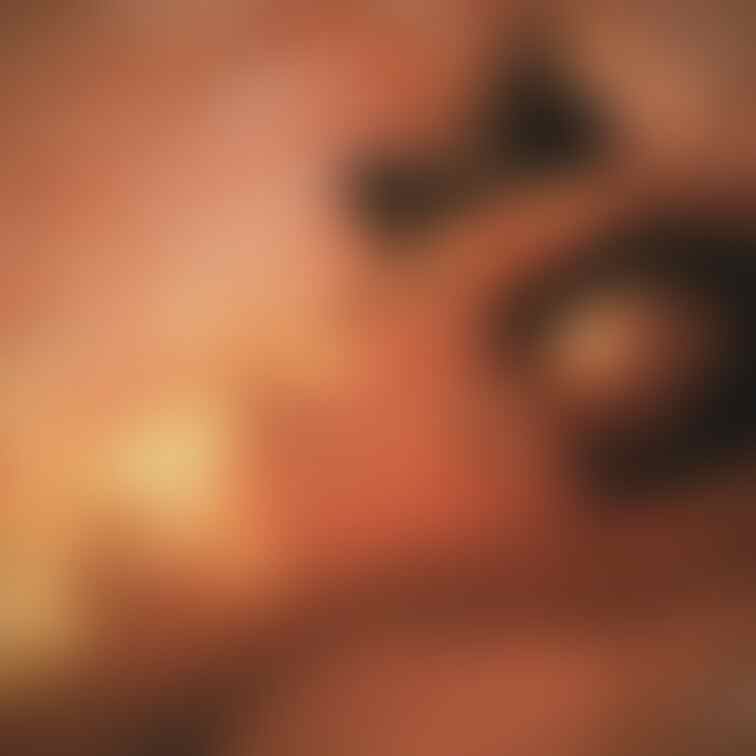 閃光