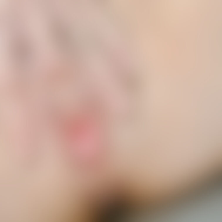🙈💕