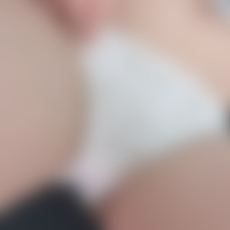 ふとももの付け根のところ