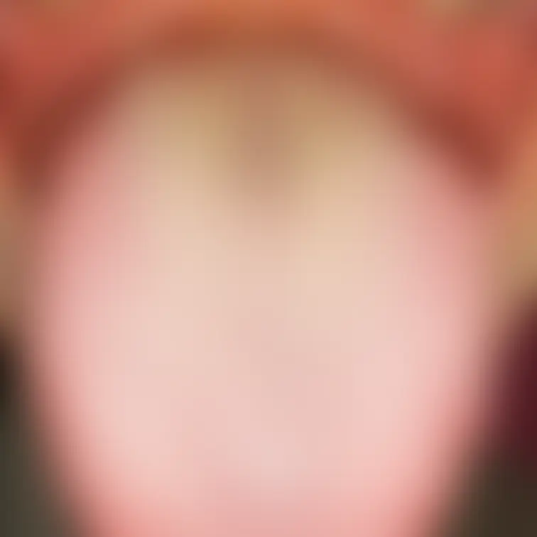 舌81