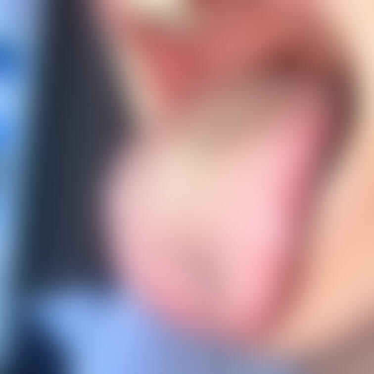 舌24