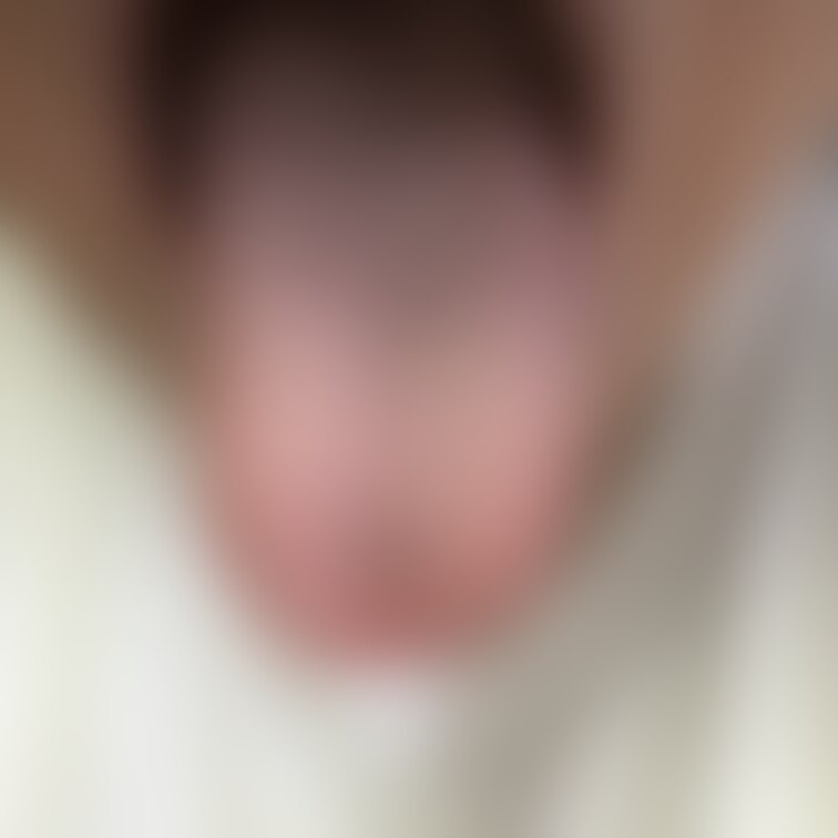 ベロ