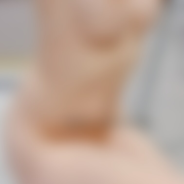 おっぱいのところに妊娠線あるんだよね😭
嫌だな…