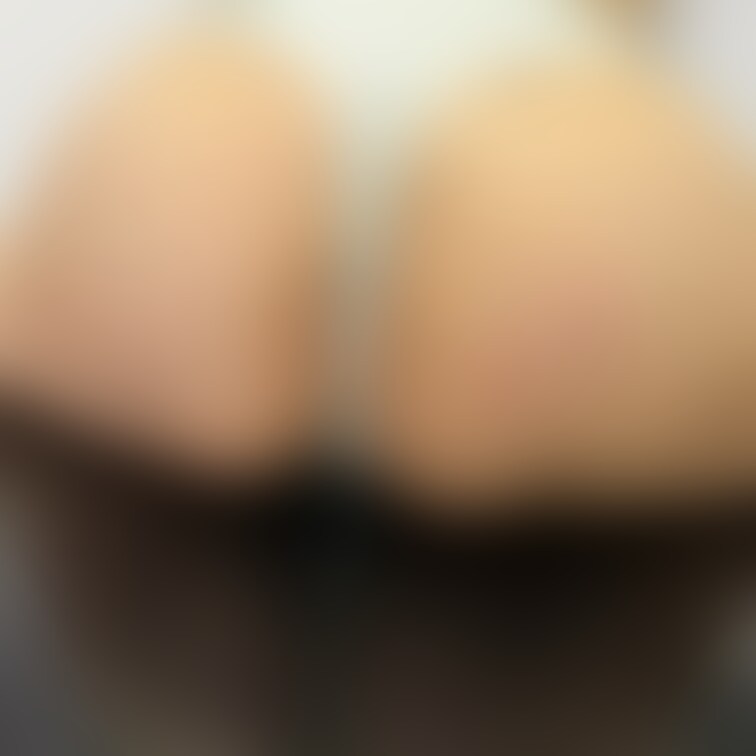 噛まれた🥹