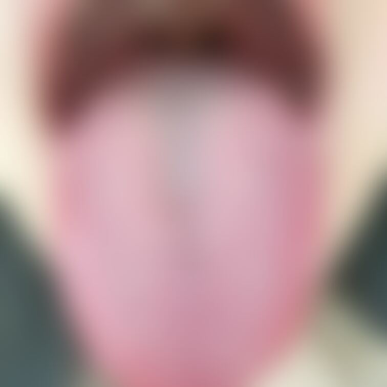 舌14