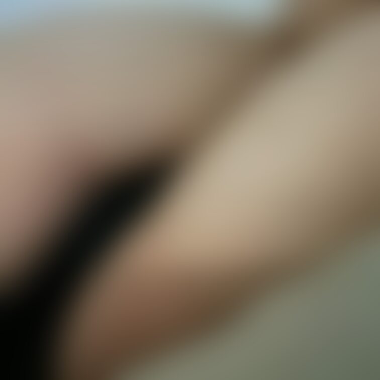 ハムストリング
