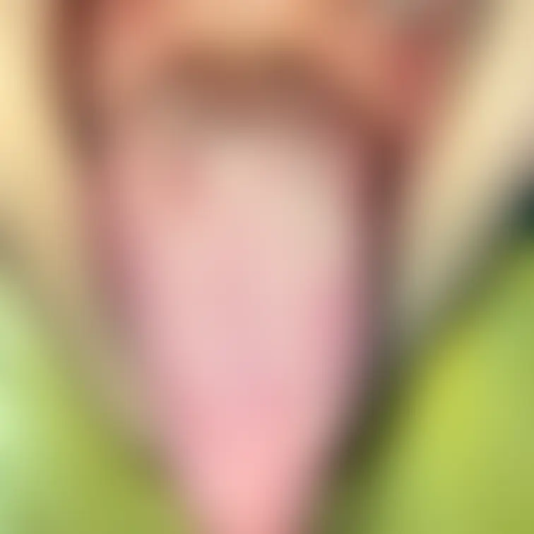 舌79