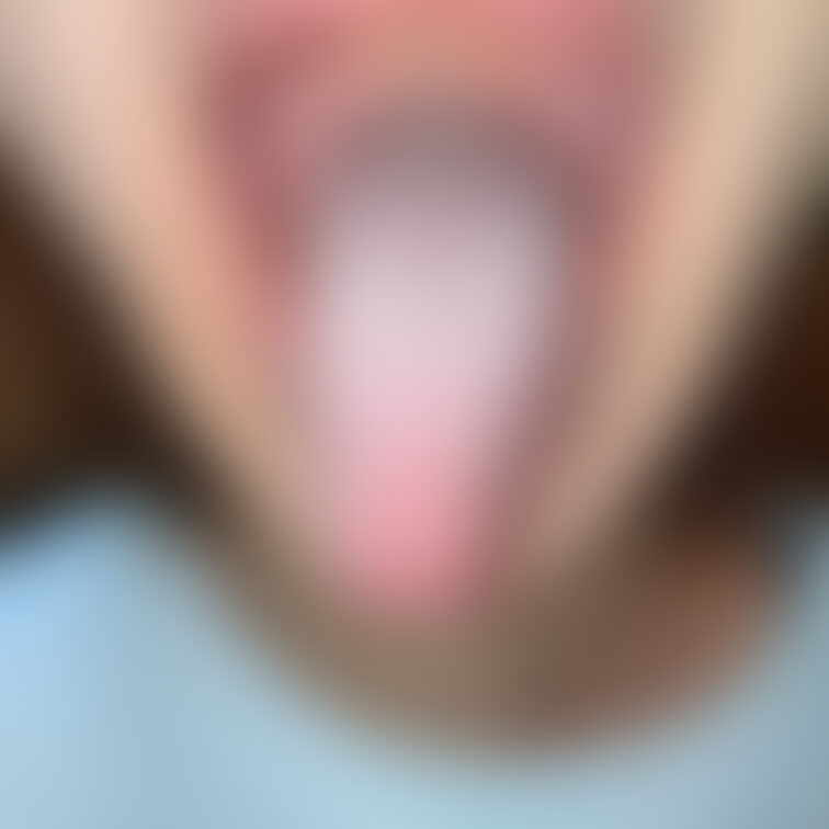 舌34