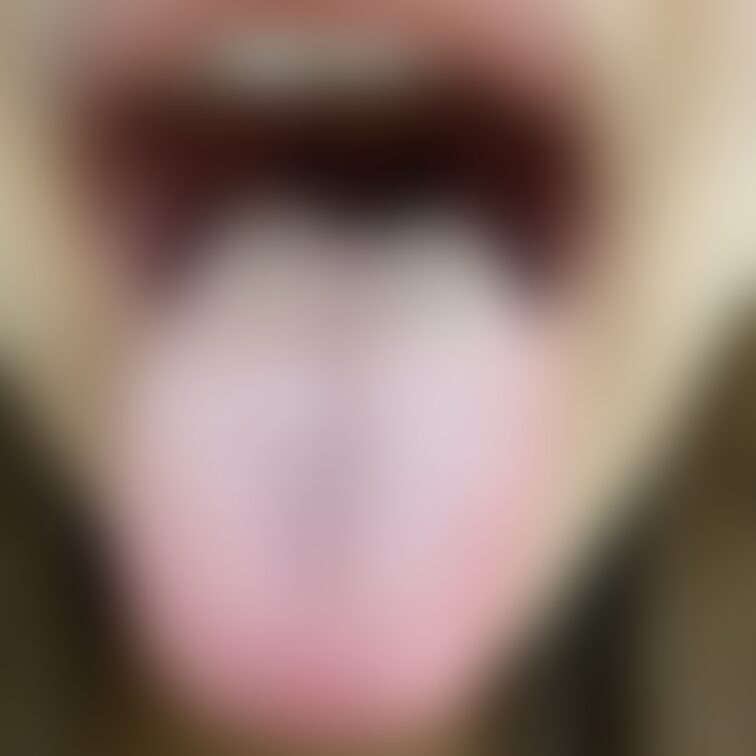 舌37