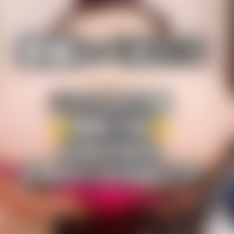 閲覧注意です🙇‍♀️お尻の穴の汚い写真です🙇‍♀️そういうのが大丈夫な人か、私のお尻の穴まで愛してくださるリアルガチ変態