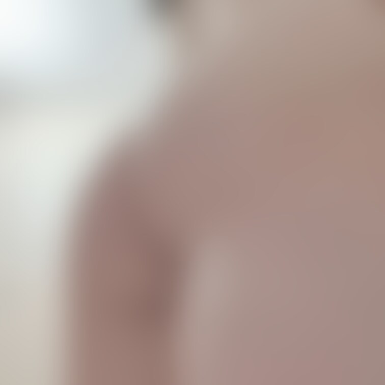 需要の有無は知りません🍑