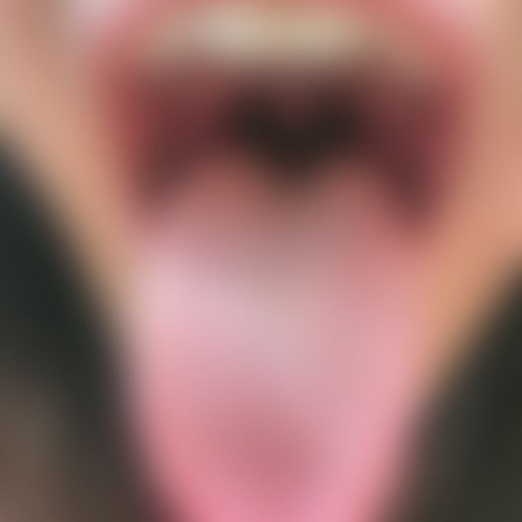舌20