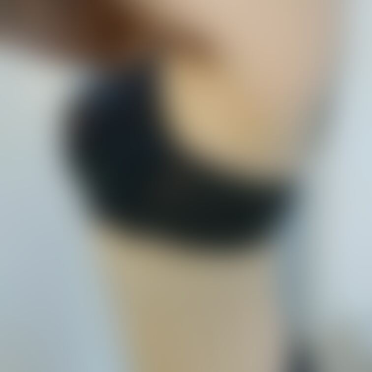 縄のアト。幸せなのです(  ´˘`  )♡