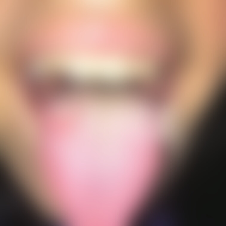 舌写真
