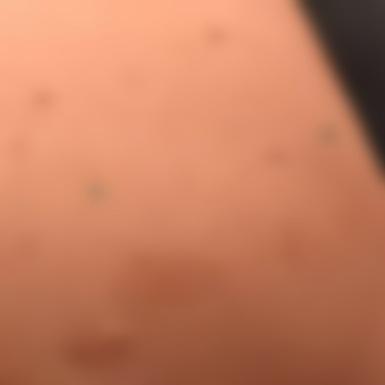 針