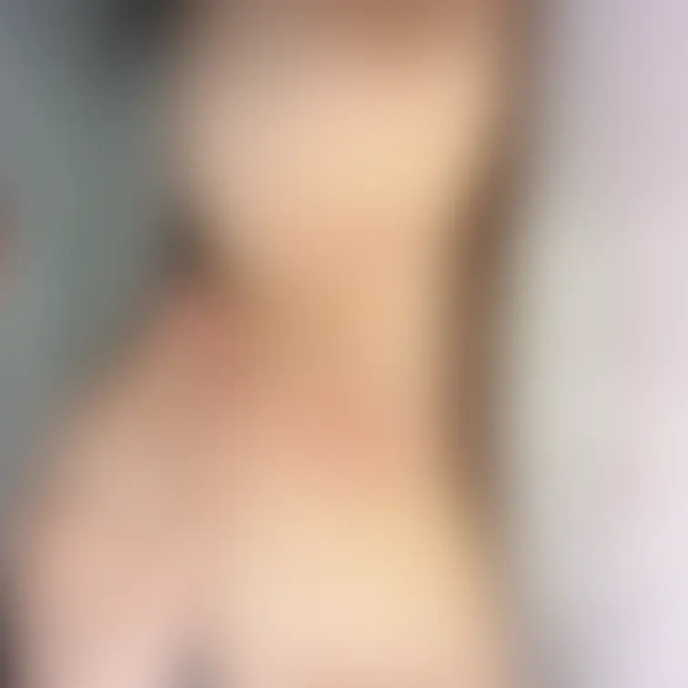 蒸れて痒くてあと残っちゃったぁ💦