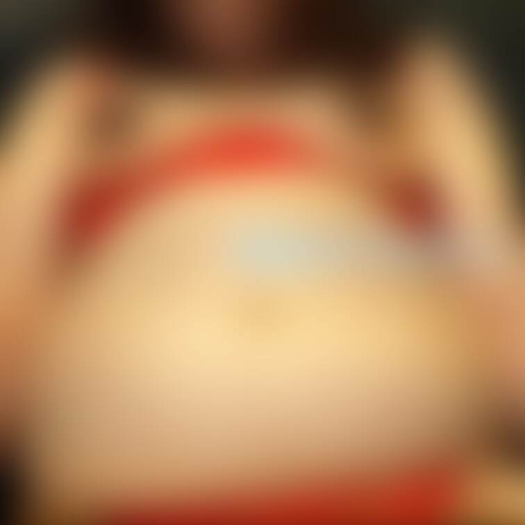 妊娠線が刺さりますよね(笑)