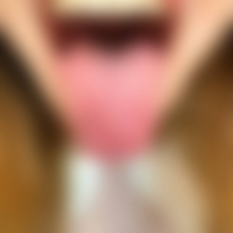 舌36