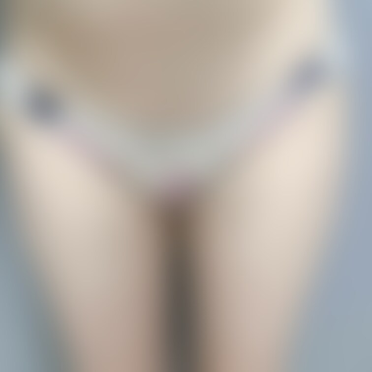 シミがついていました、、恥ずかしいですがぜひ見てください✨