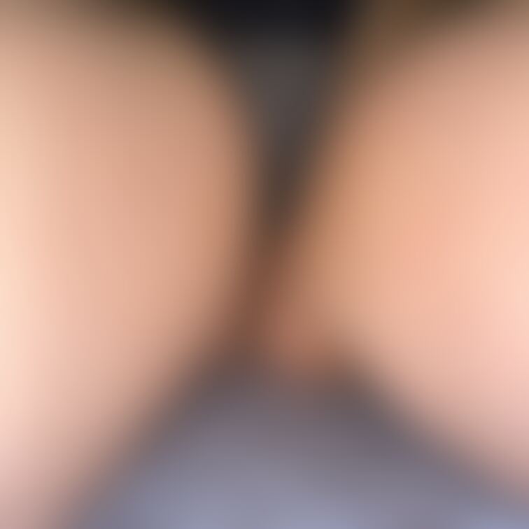ハニーフラッシュ