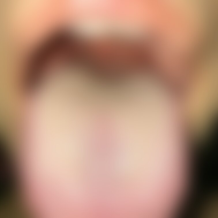 舌2